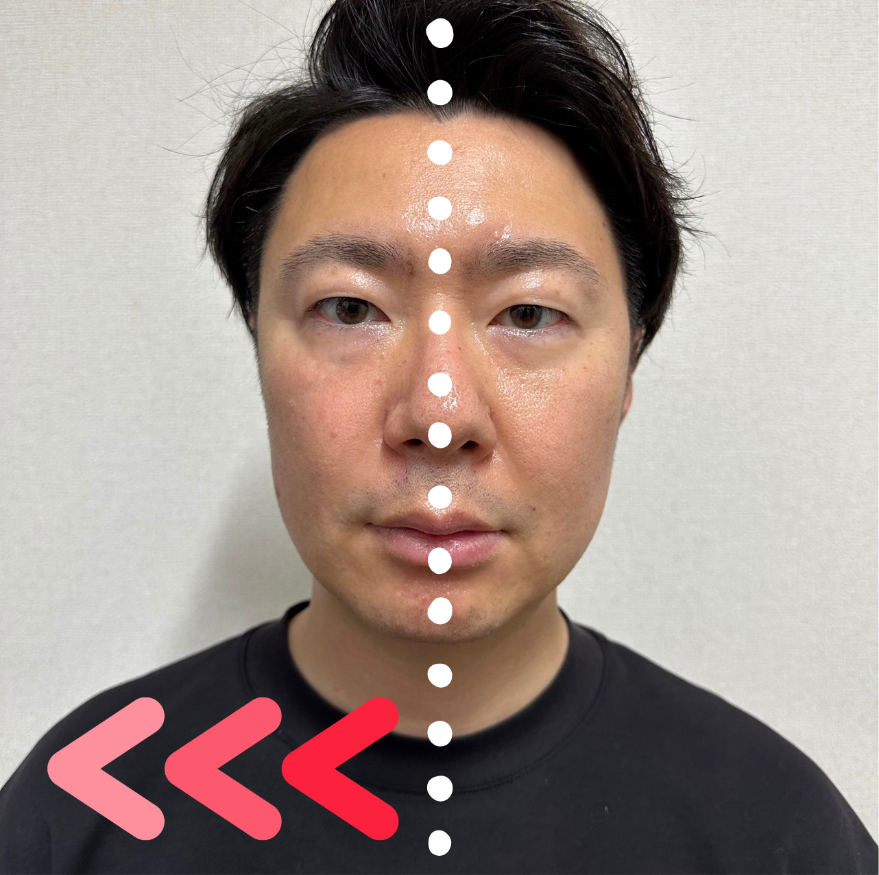 ビーラブコスメ】最上級のスキンケア商品をビフォーアフター画像